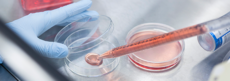 Evaluation of contracted cell culture